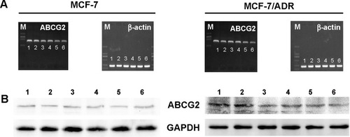 Figure 7 Expression of ABCG2 mRNA (A) and protein (B) after transfection with different siRNA formulations.Notes: (A-1) and (B-1) PBS control, (A-2) and (B-2) negative control-siRNA, (A-3) and (B-3) free siRNA, (A-4) and (B-4) free siRNA + UTMD, (A-5) and (B-5) siRNA-loaded PEAL NPs, (A-6) and (B-6) siRNA-loaded PEAL NPs + UTMD.Abbreviations: siRNA, small interfering RNA; PEAL NPs, mPEG-PLGA-PLL nanoparticles; mPEG-PLGA-PLL, monomethoxy polyethylene glycol–polylactic acid/glycolic acid–poly(L-lysine) triblock copolymer; UTMD, ultrasound targeted microbubble destruction; PBS, phosphate buffer saline.