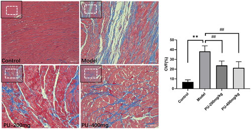 Figure 4. Punicalagin alleviated myocardial fibrosis and CVF via Masson staining (×100 and ×200). Values are expressed as mean ± SD (n = 10). **p < 0.01 vs. Sham group; ##p < 0.01 vs. model group.