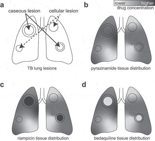 Figure 1. Diagram of tissue drug distribution in Mtb-infected lungs. Diagram of lungs with cellular (solid arrow) and caseous (dashed area) lesions (a). Pyrazinamide penetrates both lesion types (b) [Citation22,Citation101]. Rifampicin penetrates both lesion types and accumulates in the caseous core (c) [Citation22,Citation112]. Bedaquiline penetrates cellular lesions but is partially excluded from the core of caseous lesions (d) [Citation101]. The relative drug concentration scale (from low to high) is shown in greyscale bar in the upper right.
