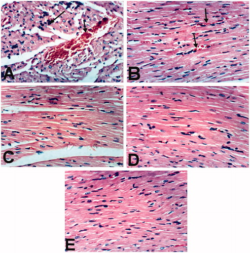 Figure 4. Heart of rat treated with (A) Indomethacin showing congestion of myocardial blood vessel (small arrow) and few mononuclear inflammatory cells infiltration (large arrow). (B) BCO showing slight congestion of myocardial blood capillaries (arrow). COO (C), CLO (D) and control (E) showing no histopathological changes (H & E x 400).