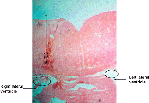 Figure 2.  Section of the rat brain at the position for the probe inserted in.