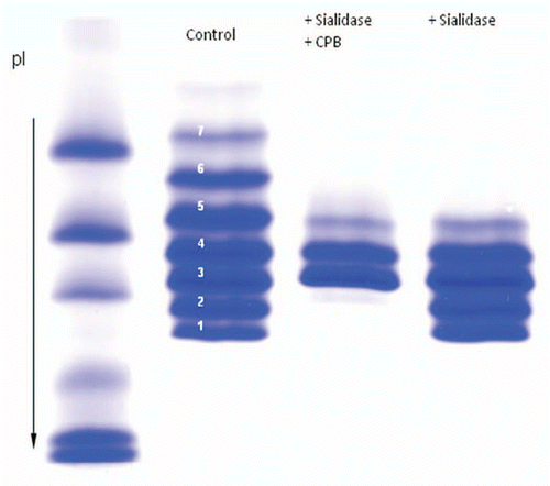 Figure 5 Effect of sialidase and carboxypeptidase treatment on the IgG1 product. The Isoforms 1 and 2 are not present in the sialidase and carboxy peptidase treated sample but they are present in sialidase treated sample. Isoforms 6, 7, 8 are not present in sialidase treated sample indicating that they contain sialic acid.