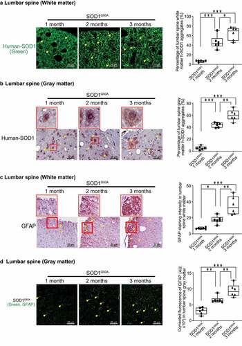 Figure 3. Human SOD1G93A protein was aggregated, and GFAP protein was increased during ALS progression. Aggregation of human-SOD1G93A protein was observed in the lumbar spine white matter (a) and gray matter (b) starting in 2-month-old SOD1G93A mice in immunofluorescence staining, immunohistochemistry staining and human-SOD1 protein aggregates percentage analysis. Images are from a single experiment, representative of 6 mice per group. (Data are expressed as mean ± SD. n = 6, one-way ANOVA test, *P < .05, **P < .01, ***P < .001). GFAP expression was enhanced starting from 2-month-old in the lumbar spine white matter (c) and gray matter (d) in the SOD1G93A mice in immunofluorescence staining, immunohistochemistry staining and GFAP staining quantification. Images are from a single experiment, representative of 6 mice per group. (Data are expressed as mean ± SD. n = 6, one-way ANOVA test, *P < .05, **P < .01, ***P < .001)