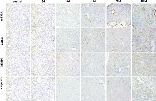 Figure 5 Dynamic changes of fibrosis related cytokines and cell apoptosis in immunohistochemistry (x200).