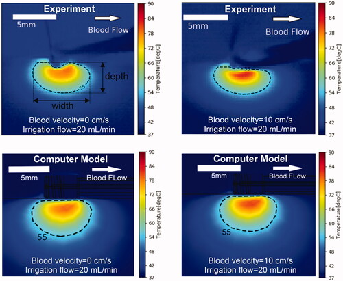 Figure 5. Temperature profiles of representative parallel catheter orientation of experiments (top) and computer simulations (bottom). Results are shown at the end of the 60 s ablation at constant power of 5 W, for an irrigation flow rate of 20 ml/min and blood velocity of either 0 or 10 cm/s. Direction of blood flow is indicated in the upper right image. The 55 °C isotherm is an estimate of thermal lesion size.