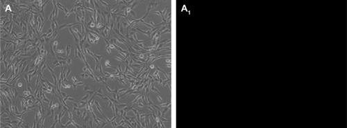 Figure 5 C6 cell uptake drug assay.Notes: Fluorescence microphotographs showing C6 cells treated with empty micelles (A and A1), free curcumin (B and B1), and Cur/MPEG-PLA micelles (C and C1) at a concentration of 6.4 μg/mL after 4-hour incubation. Curcumin shows green fluorescence under fluorescence microscopy. A–C are bright-filed images and A1–C1 are fluorescence images.Abbreviations: Cur, curcumin; MPEG-PLA, monomethoxy poly(ethylene glycol)-poly(lactide) copolymer.