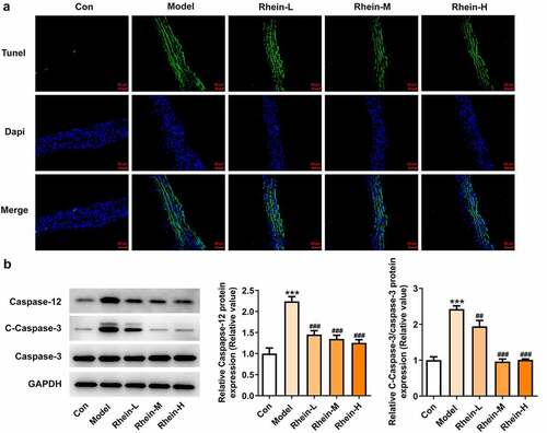 Figure 5. Rhein suppressed cell apoptosis of vascular tissues. The rats of different groups received the following treatment for six weeks, respectively. normal chow, high-fat diet (HFD) (D12492, 60% kcal%, Research Diets, USA), high-fat diet +Rhein-L (lose dose), high-fat diet (60% kcal%) + Rhein-M (medium dose), high-fat diet (60% kcal%) +Rhein-H (high dose). (a) Tunel analysis of vascular tissues. (b) Western blotting analysis of caspase12 and 3. n = 6 rats/group. HFD, high-fat diet-fed rats. ***p < 0.001 versus control. ##p < 0.01, ###p < 0.001 versus HFD