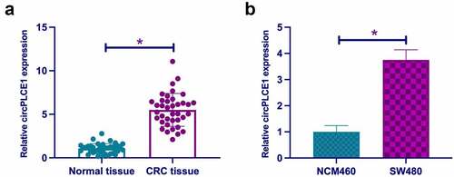 Figure 1. Elevation of CircPLCE1 is in CRC A. RT-qPCR to detect circPLCE1 in CRC and adjacent normal tissues; B. RT-qPCR to detect circPLCE1 in CRC cell line SW480 and human normal colonic epithelial cell line NCM460. Expression of the data was as mean ± SD (B, n = 3); *P < 0.05.
