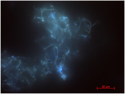 Figure 3. Epifluorescence micrographs of native biofilm under excitation with UV illumination corresponding to autofluorescence of chlorophyll a. A 3D composite image (not shown) showed the chlorophyll was distributed throughout the biofilm, meaning there was no spatial segregation of the phototrophs.