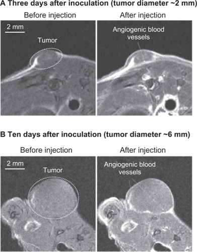 Figure 10 T1-weighted magnetic resonance images of colon cancer in the anesthetized mouse injected intravenously with PEG1100-grafted multimodal QD655 embedded with gadolinium (1 μmol/kg bodyweight, single dose). Dashed lines indicate tumor area (including angiogenic vasculature). The images were obtained immediately after injection, using 7.0 Tesla magnetic resonance imaging. Imaging parameters: spin echo sequence with fat suppression preparation pulse; repetition time 400 msec; echo time 9.574 msec; field of view 32 × 32 mm; matrix size 256 × 256; slice thickness 1.0 mm; number of averages 4.Abbreviations: QD, quantum dot; PEG, polyethylene glycol.