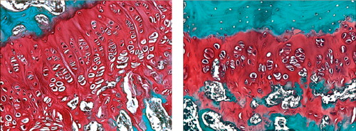 Figure 6. Photomicrographs of histological sections showing remaining lateral physis 8 weeks postoperatively.(a) Left tibial physis showing chondrocytes with near-normal columnar arrangement.(b) Right tibial physis showing reduced physeal height and irregularly arranged chondrocytes, suggesting premature physeal growth arrest (× 100, Safranin-O).