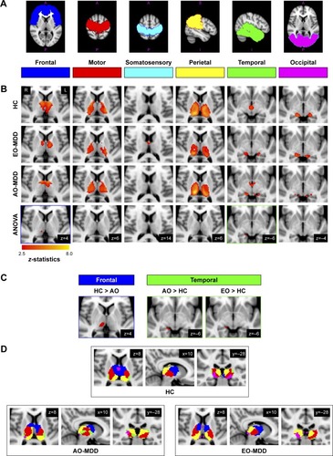 Figure 1 Statistical maps of thalamocortical connectivity in EO-MDD and AO-MDD patients and HC: (A) six cortical ROIs used as seed regions in the seed-to-voxel analysis of thalamocortical connectivity; (B) the first three rows show group mean clusters from HCs and EO-MDD and AO-MDD patients. The fourth row displays significant clusters showing a main effect of group from ANOVA results; (C) significant clusters emerging from group contrasts (showing only clusters that overlap with group main effects from ANOVA results); (D) overlaid group mean clusters to demonstrate differences in the spatial distribution of thalamocortical connectivity regions in the thalamus across all the three groups.