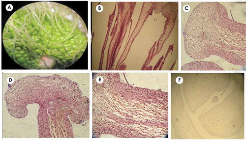 Figure 7. (a–f) Morphological and anatomical structure of pome like and false fruit and its simple drupelets. (a) Pome like fruits with styles located in the center of each drupelet. (b–e) Longitudinal view of perianth with grown and globular apex; the elongated and detached cells located in the middle of perianth are secretory. (f) Perianth structure and its secretory cells in the transverse view, simple fruit is observed in the centre of perianth.