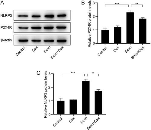 Figure 3. Dexmedetomidine attenuated sevoflurane-induced P2X4R and NLRP3 overexpression in the hippocampus. (A) The protein expression levels of P2X4R and NLRP3 were detected by western blot (n = 3). The protein levels of (B) P2X4R and (C) NLRP3 were quantified using ImageJ software and normalized to β-actin. The data are shown as fold changes relative to proteins from Control group (n = 3). All values are expressed as the mean ± SD. **p < 0.01, ***p < 0.001.