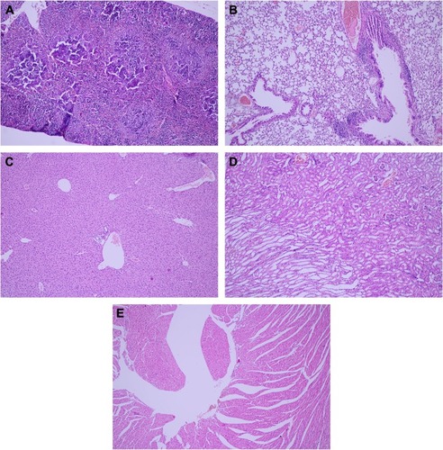 Figure 4 Pathology examination of the organs.Notes: No acute toxicity of the Tween® 20-GNPs construct over the spleen (A), lung (B), liver (C), kidney (D), and heart (E). ×20 magnification.Abbreviation: GNPs, gold nanoparticles.