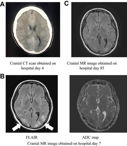 Figure 1 Images obtained over the clinical course.