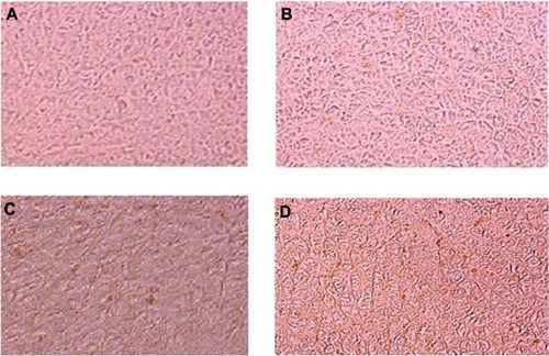 Figure 4 Photomicrograph of apoptosis in liver tissue after exposure of titanium oxide nanoparticles. (A) Control, (B) 63 mg per animal, (C) 126 mg per animal, and (D) 252 mg per animal.