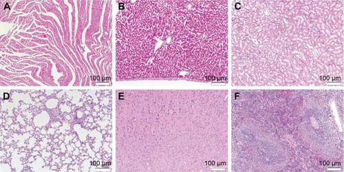 Figure 5 The major organs of rats in Rop-PELA group were sectioned and stained with hematoxylin and eosin 7 d after administration.Notes: (A) Heart, (B) liver, (C) spleen, (D) lung, (E) kidney, (F) brain (×100).Abbreviations: Rop, ropivacaine; PELA, poly ethylene glycol-co-poly lactic acid; d, day.