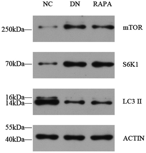 Figure 5. The mTOR, S6K1 and LC3II expression in the kidney tissues of the three groups detected by western blotting.
