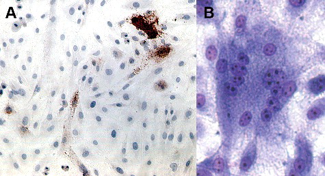 Figure 2. Photomicrographs of immortalized sheep microglia displaying evidence of infection after inoculation with SRLV-Cork. Immortalized microglial retains permissiveness to SRLV. (A) Five days after inoculation with SRLV cells demonstrated strong immunoreactivity (red-brown, intracytoplasmic staining) for SRLV nucleocapsid protein (subline A shown). 100×. (B) Five days after inoculation with SRLV and modified Wright Giemsa staining, microglial demonstrated scattered syncytial cells with numerous (>10) nuclei, a typical cytopathic effect following SRLV infection (subline H shown). 200×.