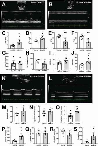 Figure 4. CKM-TD mice experience cardiac dysfunction and bradypnea. 10-week-old Con-TD (n = 9) and CKM-TD (n = 7) male and female mice were examined through echocardiography (A-J) and diaphragm ultrasonography (K-S). (A, B, K and L) Representative 2D image (upper) and M-mode diagram (lower). LVDd, left ventricular diameter – diastolic; LVDs, left ventricular diameter – systolic; EF, ejection fraction; FS, fractional shortening; Ao Peak Vel, aorta velocity peak gradient; IVCT, isovolumic contraction time; IVRT, isovolumic relaxation time. Data are presented as mean±SD with individual values. *P < 0.05, **P < 0.01, ***P < 0.001, ns non-significant in Student’s t-test.