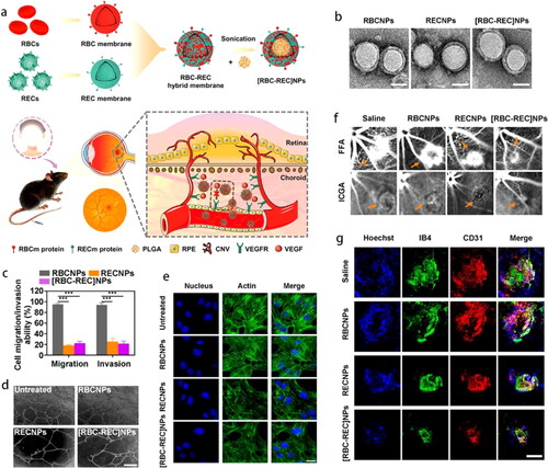 Figure 10. (a) Schematic illustration of [RBC-REC]NPs designed for noninvasive targeted treatment of laser-induced CNV. (b) TEM images. (c) REC migration/invasion ability, (d) capillary tube formations and (e) actin filaments in RECs after incubation with various NPs. (f) Representative fundus photographs of CNV regions in a mouse model. (g) Confocal images of choroid flat mounts after i.v. injections with different treatment. Blue, nucleus; green, CNV lesions; red, ECs. Scale bar, 100 μm (Li et al., Citation2021b). Copyright 2021 American Chemical Society.