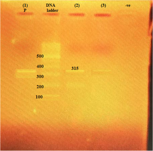 Figure 2 The 315-bp PCR amplification of armA gene among P. aeruginosa isolates. (1) P, positive control; second lane, DNA ladder, 100-bp DNA size marker; (2) and (3), clinical isolates with positive results; −ve, negative control.
