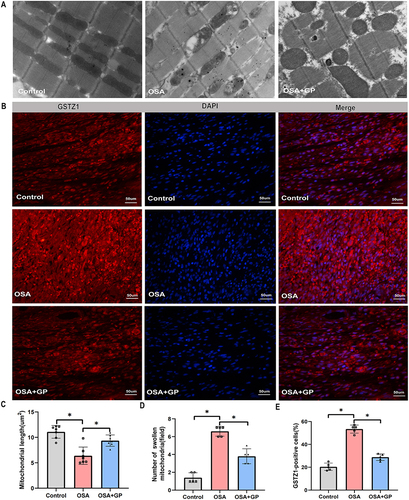 Figure 10 Verifcation of the key phenotypes and DEPs by TEM and IF analysis. (A) GP ablation suppresses OSA-induced cardiac mitochondrial damage in vivo. (B) Representative immunofluorescence staining of GSTZ1 in atrial myocardium among the three groups. (C) Quantitative analysis of mitochondrial length, (D) number of swollen mitochondria, and (E) GSTZ1-positive cells among the three groups. *P < 0.05, n = 5.