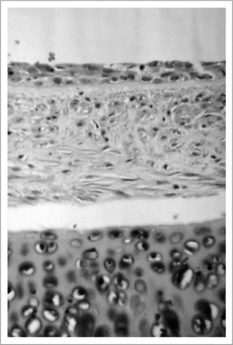 Figure 4 Histologic findings of cryopreserved tracheal xenograft 28 days after transplantation, which received short-course immunosuppression with 3.5 mg/kg/day of Tacrolimus. The epithelium shows degeneration but the cartilage is well maintained. (Hematoxylin and eosin; original magnification, ×200).