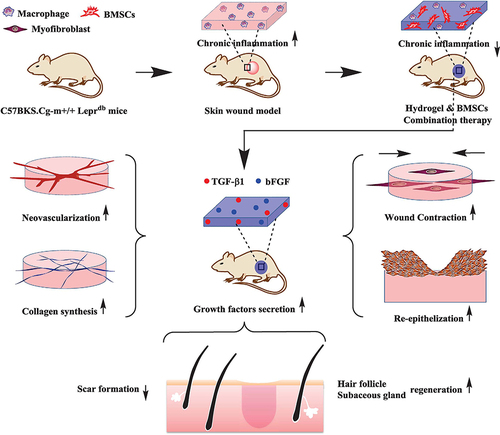 Figure 5 Diagram of MSC-loaded hydrogels for chronic wounds. Adapted with permission from Chen S, Shi J, Zhang M, et al. Mesenchymal stem cell-laden anti-inflammatory hydrogel enhances diabetic wound healing. Sci Rep. 2015;5:18104, Open Access.Citation162