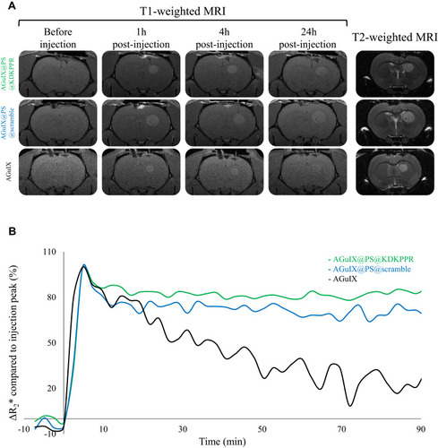 Figure 4 Tumor tissue selectivity of nanoparticles using MRI analysis in xenografted nude rats. (A) Axial T2- and T1- weighted MRI before, 1, 4 and 24h after i.v. injection of AGuIX@PS@KDKPPR, AGuIX@PS@scramble or AGuIX nanoparticles (80 µmol.kg−1, Gd equivalent). Proton density weighted MRI (TR/TE: 5000/33 ms, NEX: 2, FOV: 4×4 cm, matrix: 256×256, slice thickness: 1 mm). (B) Monitoring of the ΔR2* relaxivity after injection of AGuIX@PS@KDKPPR (in green), AGuIX@PS@scramble (in blue) and original AGuIX nanoparticles (in black). The continuous T2*-weighted sequence over 90 minutes produced 45 images in coronal section. Each MRI images made it possible to establish the mapping of the ΔR2* relaxivity over time which was then normalized with the signal in the cerebellum (data points show the mean, n = 3).