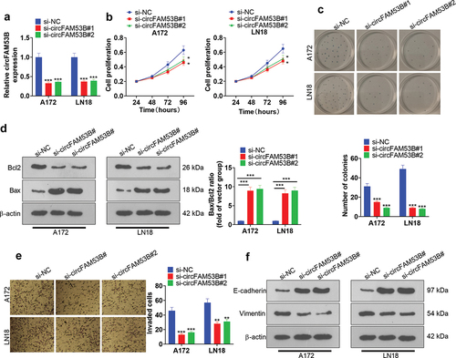 Figure 3. Influence of CircFAM53B knockdown on cell proliferation, invasion, EMT and apoptosis.