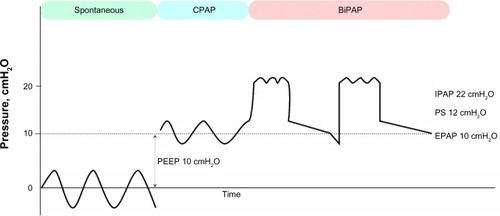 Figure 1 Pressure-time curves.