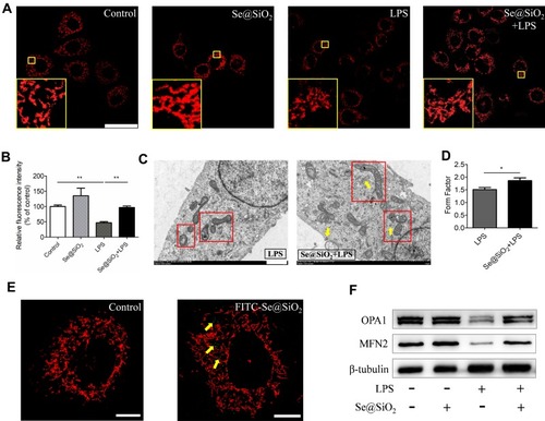 Figure 4 Porous Se@SiO2 NPs ameliorated mitochondrial dynamics under LPS stimulation in Beas-2B cells. (A) Representative confocal images showing changes in the mitochondrial morphology of Beas-2B cells; The mitochondria were labeled with MitoTracker Red CMXRos (MTR) staining solution and displayed in red. All the images were caught at the same magnifications. The scale bar represents 50 μm. Yellow boxes indicated local amplification of the mitochondria. (B) Quantification of the red fluorescence intensity in each cell exhibiting the changes in the activity of mitochondria. The relative fluorescence intensity was calculated from more than 40 cells from each group. (C) TEM images showing representative mitochondrial morphologies of LPS and Se@SiO2+LPS. Scale bar represents 1 μm. Red boxes indicated the mitochondria and yellow arrowheads indicated Se@SiO2 NPs near the mitochondria, respectively. (D) Analysis of mitochondrial FF in each group. (E) Confocal fluorescence images of FITC-labeled Se@SiO2 NPs in Beas-2B cells, shown in green; Mitochondria were labeled with MitoTracker Red CMXRos staining solution and shown in red. Yellow arrowheads indicated the distribution of Se@SiO2 NPs around mitochondria. Scale bar represents 25 μm. NP concentration = 1 μg/mL. (F) The influence of our Se@SiO2 NPs on reduced expression of mitochondrial fusion protein OPA1 and MFN2 upon LPS challenge. NP concentration = 10 μg/mL, LPS = 10 ng/mL. *p < 0.05, **p < 0.01.