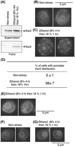 Fig. 2. BiP aggregation upon ethanol stress.Notes: (A) The IRE1+ cells remained unstressed or were exposed to ethanol stress. Total cell lysates were then fractionated by centrifugation at 8000 × g for 20 min. The supernatants (equivalent to 0.1 OD600 cells) and pellets (equivalent to 1.0 OD600 cells) were analyzed by anti-BiP western blotting.Citation2) (B) and (C) Cells were immunofluorescently stained with anti-Kar2 antiserum and pictured as described previously.Citation1) (D) The anti-Kar2 immunofluorescence-stained images were used to count cells with “punctate Kar2 distribution”, in which the nuclear ER was not observed as a closed ring. More than 100 anti-Kar2 immunofluorescently stained cells per specimen were assessed. Data are presented as the means plus standard deviations from multiple determinations. (E) kar2-1IRE1+ cells (KMY81Citation7)) were stressed by ethanol at the semi-permissive temperature of 30 °C and analyzed as done in panels B and C. (F) and (G) IRE1+ cells transformed with the eroGFP expression plasmid pPM28Citation8) were observed under a Deltavision microscope (Applied Precision).