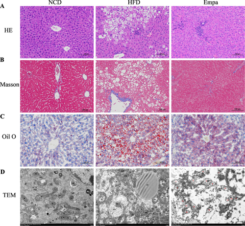 Figure 3 Effects of empagliflozin on liver histology injuries. (A) HE staining. (B) Masson staining. (C) Oil red staining. (D) TEM images showed the mitochondria, mitochondrial microautophagy structure and ribosomes.