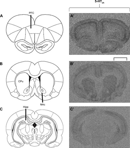 Figure 3 Examples of 5-HT2A receptor binding in the adult rat brain following childhood/adolescent APD treatment.