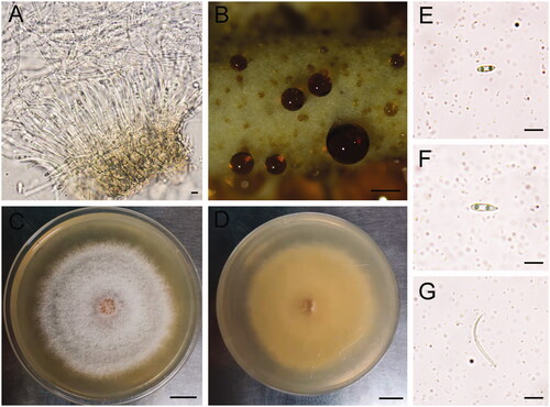Figure 1. (A) Pycnidia of Diaporthe eleutharrhenae isolated from synthetic low-nutrient agar medium (SNA) on day 15. (B) Secretion of D. eleutharrhenae on the PDA Petri dish and on day 20. (C and D) Colony morphology of D. eleutharrhenae observed from the top and below the PDA Petri dish on day 7. (E and F) Alpha conidia. (G) beta conidia. Conidia were isolated from synthetic low-nutrient agar medium (SNA). Scale bars in A, E, F, G are 5 µL. Scale bar in B is 50 µL. Scale bars in C and D are 1 cm. Shorter alpha conidia (5–8.5 µm) and the presence of beta conidia are a key character for distinguishing D. eleutharrhenae from the most closely related species D. chinensis N. I. de Silva, Lumyong & K. D. Hyde.