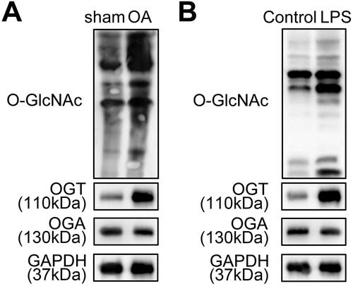 Figure 1. The levels of total O-GlcNAcylation and OGT are increased in OA models. A. The level of total O-GlcNAc and the levels of O-GlcNAc cycling enzymes (OGT and OGA) were measured in the cartilage tissues of the OA mice model and the negative control sham mice using western blot. B. The levels of total O-GlcNAc, OGT, and OGA in ATDC5 cells treated with or without LPS were determined by western blot.