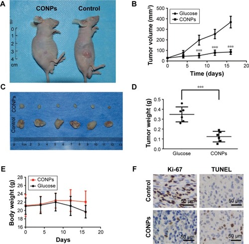 Figure 2 Antitumor effects of CONP therapy on subcutaneous prostate cancer.Notes: (A) Representative images of mice bearing subcutaneous prostate cancer from the same study on day 14. The tumors from the CONP group were significantly smaller than those from the control group. (B) Plot of tumor volume versus time. Day 0 was the start of the treatment. The mice bearing subcutaneous tumors were euthanized when exhibiting signs of illness or death. The tumor masses from the deceased mice were not included after the day of death. Each group initially contained six mice. The error bars represent ±SD. The tumors from the CONPs group were significantly smaller compared with the tumors from the control mice (***P<0.001, Student’s paired t-test, n=6). (C) Images of excised subcutaneous tumors. The diameters of the subcutaneous tumors from the CONP group were obviously smaller than the diameters observed in tumors from the control group. (D) Statistical analysis of the tumor weight from the CONP and control groups after treatment for 16 days (***P<0.001, Student’s t-test, n=6). (E) Body weight of mice in the CONPs and control groups. No significant difference in the mouse body weight of two groups was observed. (F) Ki-67 staining and TUNEL staining images. The ratio of Ki-67-positive cells in the CONP group was obviously lower than that in the control group. In addition, the number of TUNEL-positive cells was higher in the CONP group than in the control group. Magnification 200×.Abbreviations: CONPs, cuprous oxide nanoparticles; TUNEL, terminal deoxynucleotidyl transferase (TdT)-mediated dUTP nick end labeling.