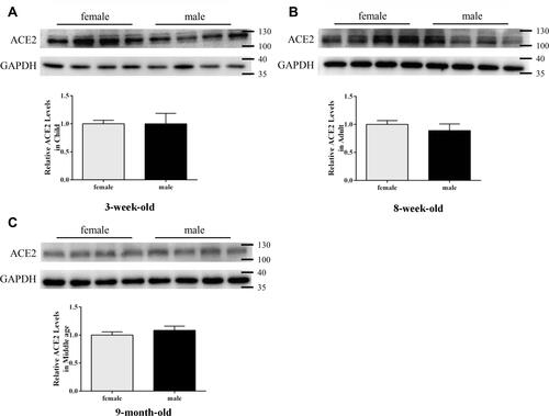 Figure 2 ACE2 expression in mouse lung tissues by Western blotting: (A) 3-week-old, (B) 8-week-old, (C) 9-month-old. GAPDH was used as a loading control. Values are represented as mean ± SD (n = 4). The sizes of the molecular weight markers are shown on the right-hand side, representing 130 kDa, 100 kDa, 40 kDa, and 35 kDa proteins.