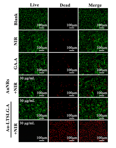 Figure 5. Fluorescence microscopic images of MCF-7 cells incubated with different treatment and subsequent brief staining. The blank group was PBS. Cells treated with NIR irradiation, GA.A (30 μg/mL), Au NRs + NIR irradiation (30 μg/mL), Au-LTSL-GA.A (30 μg/mL) were set as control groups. Cells were treated with Au-LTSL-GA.A (30 μg/mL) for 2 h in incubation and measured for 5 min upon irradiation (0.25 W/cm2). Cells were stained (for 30 min) with Calcein-AM and PI for anticancer activity.