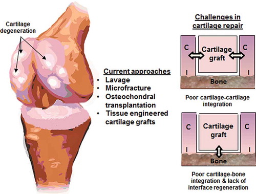 Figure 2. Challenges in integrative cartilage repair (C = cartilage; I = interface).
