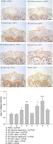 Figure 7 Intra-articular injection of L-rapa at 5 μM and 50 μM in collaboration with LIPUS enhanced type II collagen intensity stained by IHC in the cartilage of knee in spontaneous OA Dunkin-Hartley guinea pigs by approximately 1.8- and 2.8-folds compared to control (I) (Group A: PBS + sLIPUS). IHC intensity of type II collagen was quantified by Image-Pro plus 5.1 and the images were showed at 12.5 magnificence (A-H) (*P<0.05; **P<0.01; ***P<0.001; by one-way ANOVA, Group A: n=5, Groups B~G: n=8, Group H: n=3).