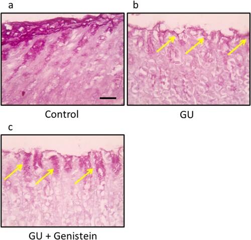 Figure 2. Gastric sections stained with PAS showing normal pink stained mucous content in mucosal layer in control group (a), glandular gastric sections from gastric ulcer group with marked deficiency in mucosal layer as indicated by the yellow arrows (b) and partial restoration of mucosal layer in gastric ulcer group treated with genistein (c). Scale bar 100 µm.