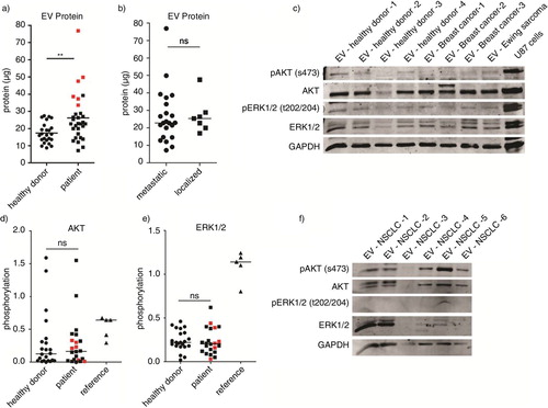 Fig. 5.  Plasma was collected from 32 patients with cancer and 28 healthy donors. Total protein yield from each isolation was measured by the Micro BCA protein assay. (a–b) Phosphorylation of AKT and ERK1/2 was measured by western blot using equal protein amounts from 21 patients and 22 healthy donors. U87 cells overexpressing EGFRvIII were used as positive control for immunostaining. (c) Signal intensities were quantified by Image J imaging analysis software and phosphorylation was measured by calculating the relative signal intensity from phosphorylated and total protein levels. Subgroup analysis was performed with patients having high EV protein levels as shown in red. (a, d–e) To determine variability in total EV kinase levels in plasma, maximum protein amounts were loaded from a subgroup of patients with NSCLC. (f) Statistical significance was tested using the 2-tailed paired Student's t-test. ns=not significant, p≤0.05, **p≤0.01, ***p≤0.001.