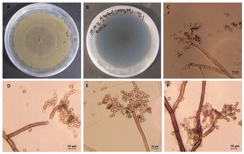 Figure 2. Morphological characteristics of Cladosporium perangustum (SM1). (A, B) Fourteen-day old colony; (C–F) Macronematous conidiophores and conidial chains. Scale bar = 10 μm.