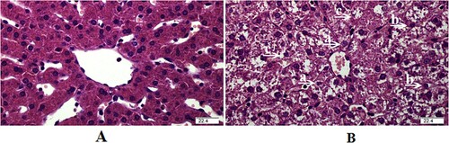 Figure 1. Representative haematoxylin/eosin-stained liver sections of the saline group (A) and LPS group (B). Caryolysis (a) and karyopycnosis (b) of hepatocytes, and (c) disordered hepatic cell cord arrangement were observed in the liver challenged by LPS.