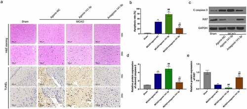 Figure 2. Administration of exogenous agomir-141-3p aggravated MCAO-mediated brain injury and apoptosis in vivo.