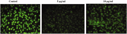 Figure 5. Anticancer activity of biosynthesized Siberian ginseng gold nanoparticle. Apoptotic effect of SG-GNPs on mitochondrial membrane premeability in murine melanoma cell line B16 was assessed using 1 mM Rhodamine 123 staining technique. B16 murine melanoma cells were treated with 5 and 10 µg/ml SG-GNPs and incubated for 24 h. The control and treated cells were then stained with Rhodamine 123 stain for 15 min. The experiments were performed in triplicates.